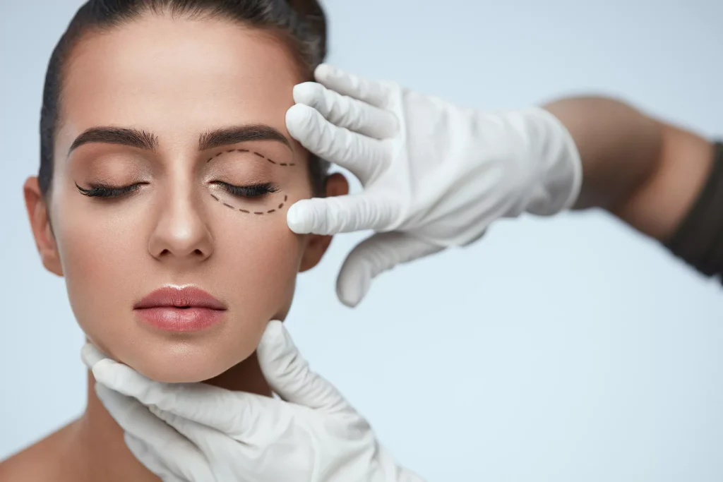 تجميل الجفون