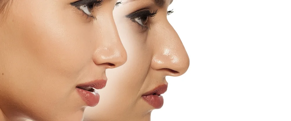 عمليات تصغير الأنف